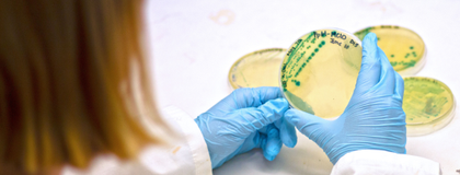 student looks at bacteria on petri dish