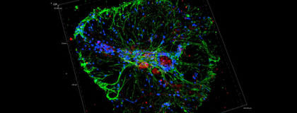 microscopic image of brain tissue